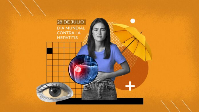 Hepatitis vírica es una inflamación del hígado